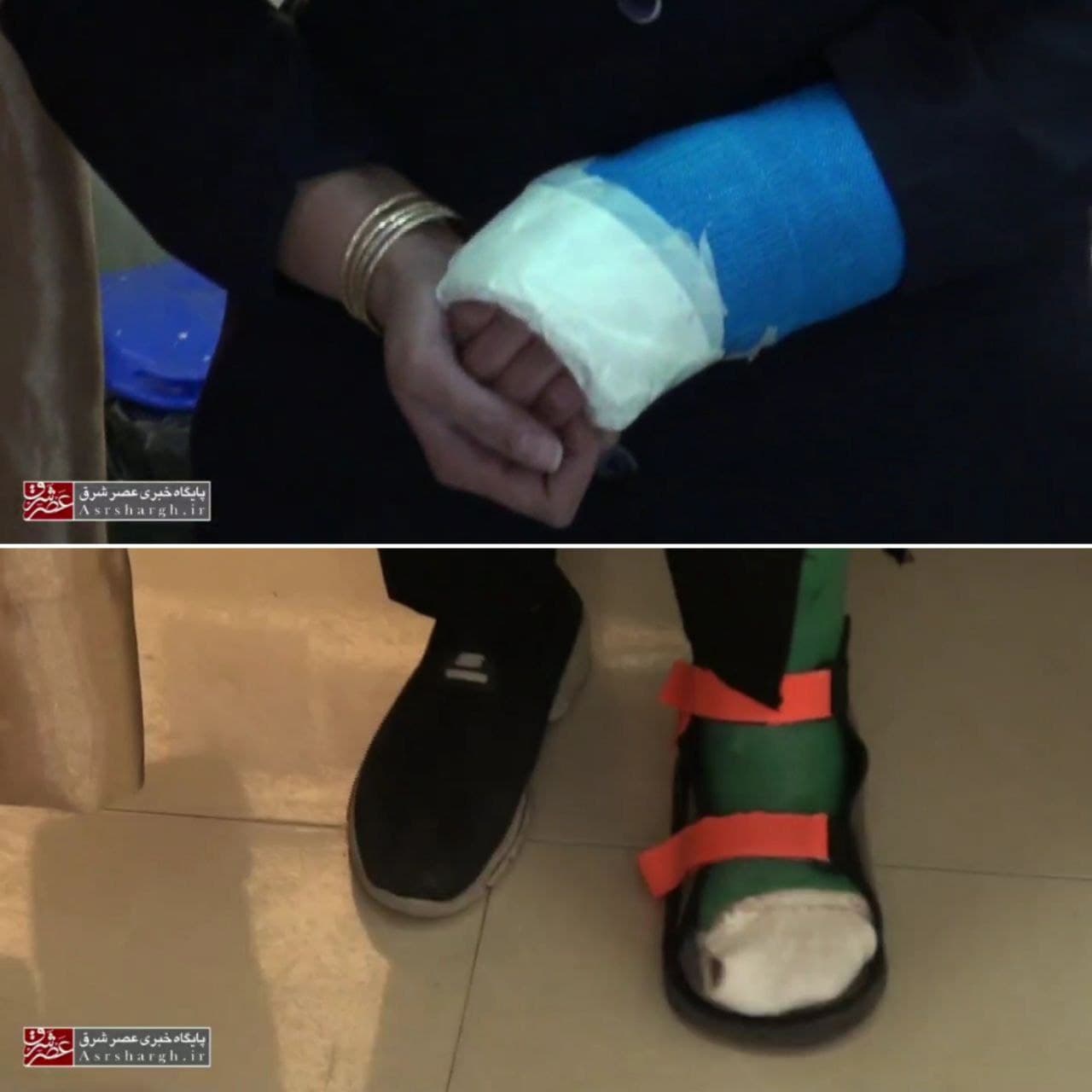 فیلم| پرستار دماوندی با دست و پای شکسته در خط مقدم مبارزه با کرونا!