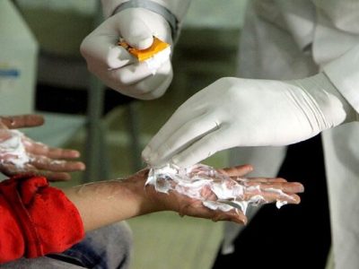 از نقص عضو انگشتان دست تا آسیب‌دیدگی جدی ناحیه چشم در دماوند/ حوادث چهارشنبه آخر سال ۱۶ مصدوم برجای گذاشت