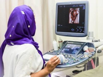 سونوگرافی بیمارستان سوم شعبان دماوند در «نوبت عصر» فعال شد